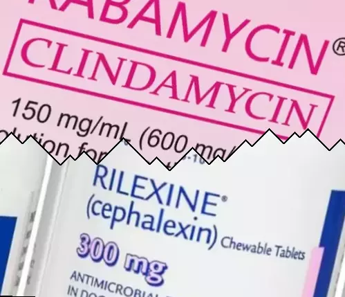 Klindamycin mot Cephalexin